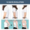 FunnAura Back Posture Corrector Men Women, Back Brace Posture Corrector for Prevent Hunchback & Improve Posture