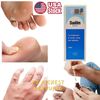 DUOFILM Solution 15ml Treatment Remove Warts Corns Calluses with Salicylic Acid