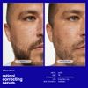 (Malin + Goetz) Retinol Correcting Serum 30 ml