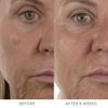 Noble Panacea, The Absolute Intense Renewal Serum, 7 Doses