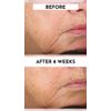 Lawless Forget the Filler Perfecting Cream