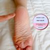 Feet Salve 4oz