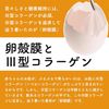 AngeAile Egg Sheet Masks 33 Pieces + Sticker with Original Logo