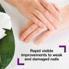 Emtrix Nail Renewal with Natural Tea Tree Oil, For Damaged Nails | Nail Strengthener and Healthy Nail Growth Product | For Fingernails and Toenails | Vegan Friendly | 10 ml