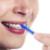 80 Pieces Multi-Color Orthodontic Ligature Ties Orthodontic Elastic 2080 O-Rings Braces Bands