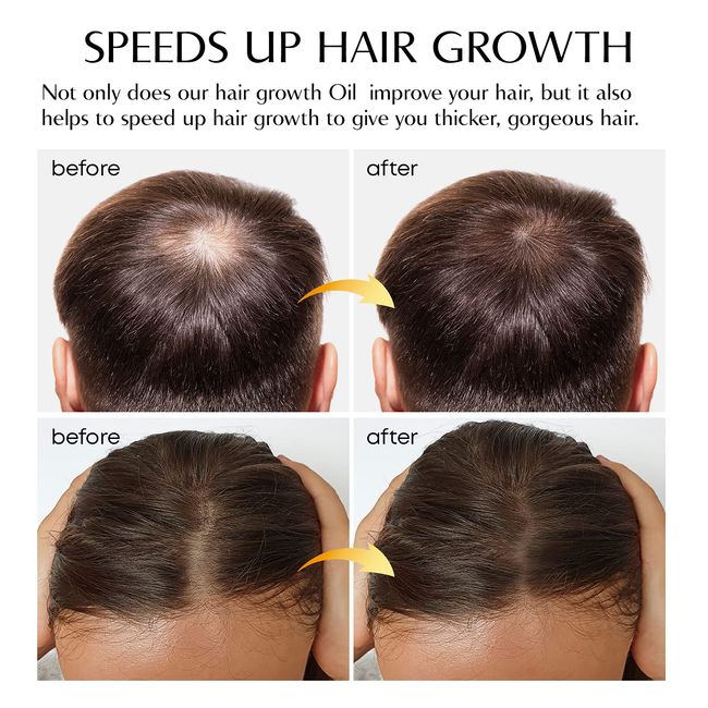 Hair Growth Oil by VigorWell Ginger Hair Oil Prevent Hair Loss and Natural  Serum for Men and Women Thicker, Stronger, Longer Hair All Hair Types   Oz (50 ml) - EveryMarket