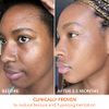 Dr. Dennis Gross Alpha Beta Universal Daily Peel: for Uneven Tone or Texture and Fine Lines or Enlarged Pores, (30 Treatments)