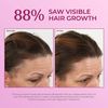 BosleyMD Hair Regrowth Treatment Regular Strength By for Women - 2 X 2 Oz Treatment, 2count