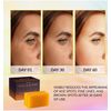 Skin Lightening Kojic Acid Soap