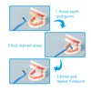 NITAIUN 5 Pieces Remover Tooth Cleaning kit, Teeth Stain Eraser Teeth Polishing Cleaning Kit Whitening Cleaning Eraser Oral Hygiene Care Tool