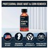 DermaEX  Liquid Wart & Corn Remover Mask 