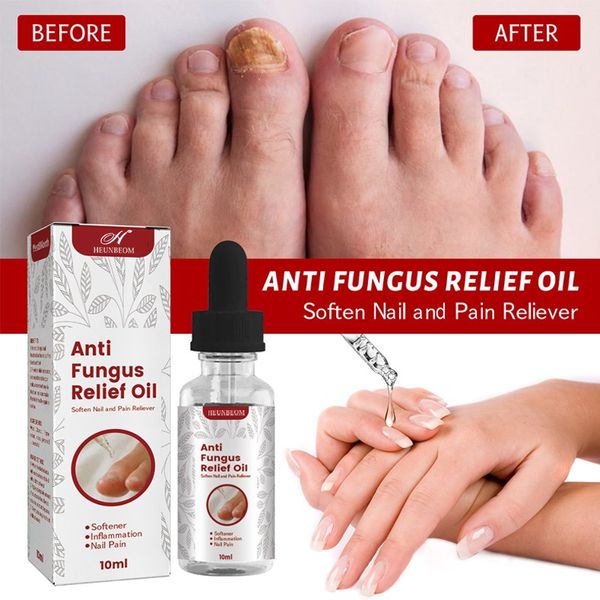 Toenail fungus nail repair essence top toenail strengthening nail nutrition supplement