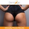 Anti-Acne Thigh & Buttocks Treatment - Clears Away Acne, Pimples, and Ingrown Hairs for the Buttocks and Thigh Area. Prevents Future Breakouts. 6.09 oz