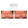 DERMA E Skin Firming Antioxidant Cleanser 175ml