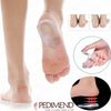 PEDIMEND™ 2PCS Silicone Heel Pads Shoe Inserts Posture Correction Gel Heel Cups