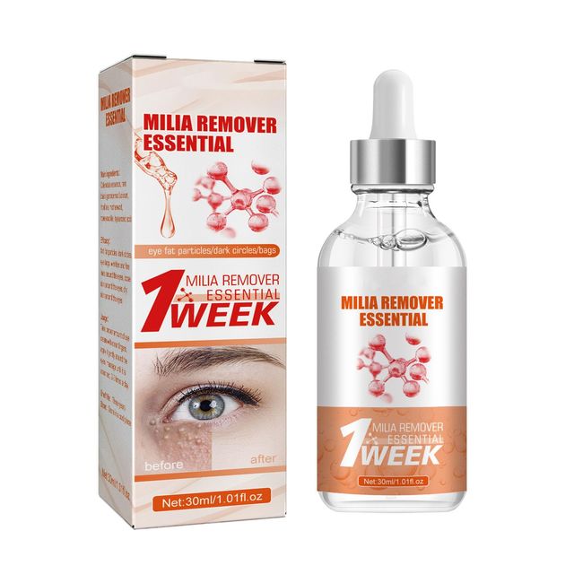 Milia Remover, Milia Spot Serum for Face, Milia Spot Removal Helps to Ruduce Milia, Dark Circles Under Eye for Women & Men, Anti Aging Anti Wrinkle, Reduces Bags, Saggy Skin & Puffy Eyes