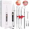 Dental Tartar Scaler Tooth Scraper Endodontic Teeth Plaque Calculus Remover Tool