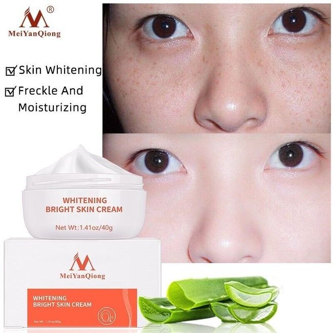 Powerful Whitening Freckle Cream Remove Acne Spots Melanin Dark Spots Face