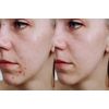 Vitality Precision Skin Microdermabrasion Scrub