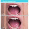 Womcare Temporary Tooth Repair kits for Filling The Missing Broken Tooth and Gaps-Moldable Fake Teeth and Thermal Beads Replacement Kits