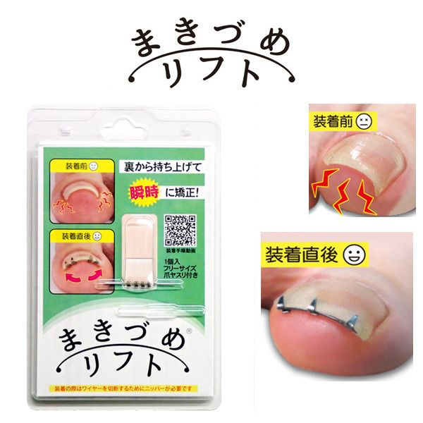 Ingrown Nail Lift &lt;Mail Order&gt; Ingrown Nail Lift Ingrown Nail Correction Wire Ingrown Nail Care Adjustable Size Made in Japan