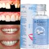 Tooth Repair Kit - Temporary Teeth Replacement Kit for Missing & Broken Teeth US
