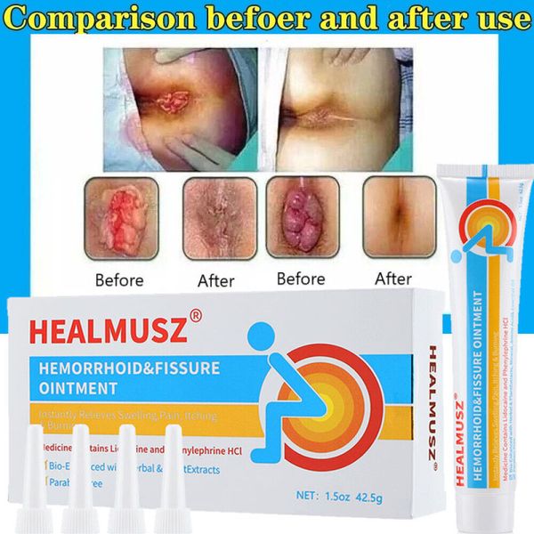 Hemorrhoids Remove Ointment Herbal Cream Fast Relief Piles Pain Reduce Itching
