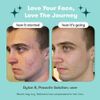 Proactiv Solution 3-Step Acne Treatment 30 Day Starter Kit – New & Sealed