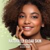 Naturally Clear Skin Botanical Replenishing Moisturizer
