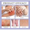 Natural Relief Blend Eczema Relief Cream