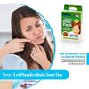 Acne Care Pimple Patch Absorbing Cover - Hydrocolloid Bandages (108 Count) Two Universal Sizes, Acne Spot Treatment for Face & Skin Spot Patch That Conceals Acne, Reduces Pimples and Blackheads