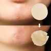 1+1 Elizavecca Acne Cover blemish Spot Patch Hydrocolloid Patches 44+44 = 88 Count (12mm 12 Count, 10mm 8 Count, 8mm 24 Count x 2) / spot patches, Vegan-friendly, Not Tested on Animals, Acne Pimple Patch for Covering Zits and Blemishes, Spot Stickers for 