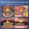 SP-6 Toothpaste, Whitening Sp-6 Toothpaste, Sp-6 Probiotic Whitening Toothpaste