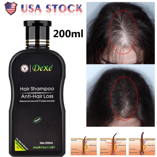 Dexe Original Anti Hair Loss Shampoo Natural Herbal Hair Growth Treatment 200ml