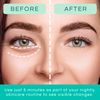 Patchology Restoring Night Eye Gels - Under Eye Patches For Dark Circles and Puffy Eyes Care - Hydrating Eye Mask Patch with Retinol - Eye Bags, Puffiness & Wrinkles Reducer (5 Pairs)