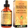 Frankincense Essential Oil (4 oz), Premium Therapeutic Grade, 100% Pure and Natural, Perfect for Aromatherapy, Diffuser, DIY by Mary Tylor Naturals