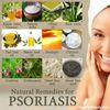 scaly skin salve