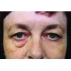 RX Flawless Eyes - 1 x 10ml Bottle. 100 Applications