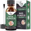 Extra Strong Nail Fungus Treatment -Made in USA, Best Nail Repair Set, Stop Fungal Growth, Effective Fingernail & Toenail Health Care Solution, Fix & Renew Damaged, Broken, Cracked & Discolored Nails
