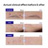 MEDIHEAL: Derma Clear Teatree Trouble Spot Patch 44 Patch Derma Clear Teatree Trouble Spot Patch 44 Patch