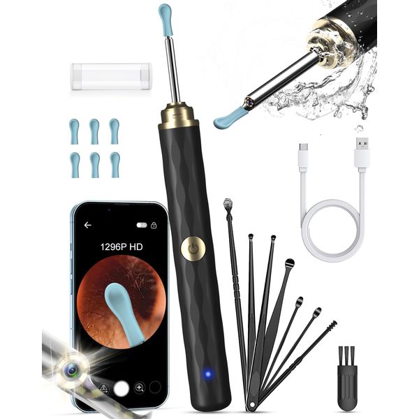 Kekoy Ear Wax Removal Kit Otoscope Ear Camera 1296P HD, WiFi Ear Cleaner with Camera, Rechargeable Ear Wax Remover Tool with Camera, Ear Wax Removal Tool with Lights for Adult & Kid(Black Gold)