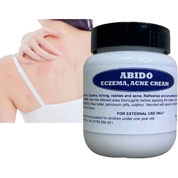 Alvies® Abido Herbal Antibacterial Cream, Anti-itch Relief Eczema Skin Rash Treatment