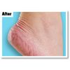 O'Keeffe's Healthy Feet, 91g, Packaging may vary