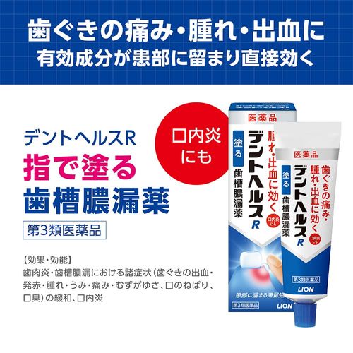 【第3類医薬品】デントヘルスR 10g