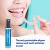 AlignerFresh Portable WhiteFoam Spray | Retainer & Invisalign Compatible Cleaner Spray - On The Go Aligner Cleaning & Teeth Whitening. Kills Bacteria & Freshens Bad Breath. Mint Flavored (1 Pack)