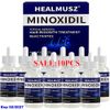 Minoxidil for Men 5% Extra Strength Hair Regrowth Solution, 10 Month Supply