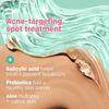 Almay Clear Complexion Concealer 0.3 Fl Oz Acne Prone Skin Full Coverage Matte