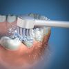 Waterpik Dental Water Jet Toothbrush Replacement Tips (Pack of 2)