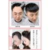 YOYO Partial Wig, Hairline, Hair Lines, Extra Thin, 100% Human Hair, Hair Implant, Men's, Hair Piece, Excellent Breathability, Super Natural, High Forehead, Bangs Wig, For Medical Use, Thin Hair Shedding, Circular Alopecia, Hair Loss Concealment, Hair Ext