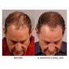 SDY Hair Solutions Reconstructive Shampoo